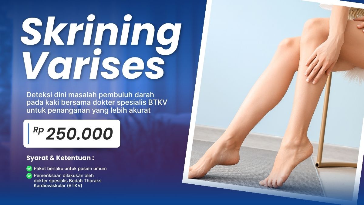 Paket Skrining Varises RS Delta Surya