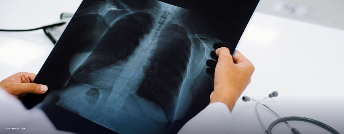 banner radiologi rs delta surya sidoarjo